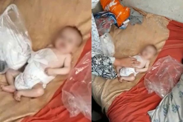 Bakıda 5 aylıq körpə ata-anasına görə ölümlə üz-üzə qaldı - FOTO Bakıda 5 aylıq körpə ata-anasına görə ölümlə üz-üzə qaldı - FOTO