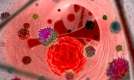 Herpes xərçəngi müalicə edir    - Yeni metod