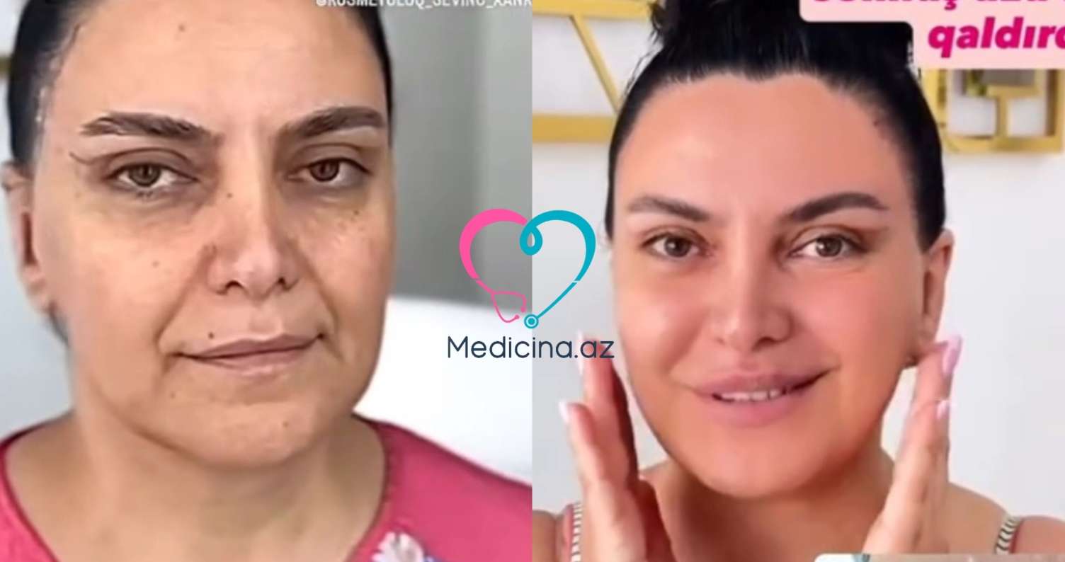 Bakıda qadının dəyişimi hamını şoka saldı -  VİDEO