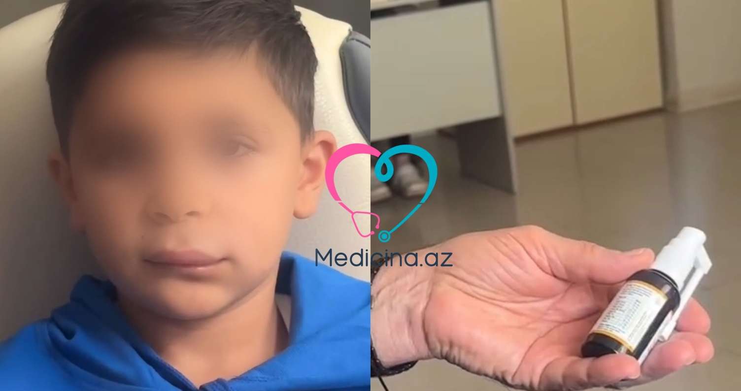 Boğaz spreyindən sonra uşağın üzü  dəhşətli hala düşdü - VİDEO