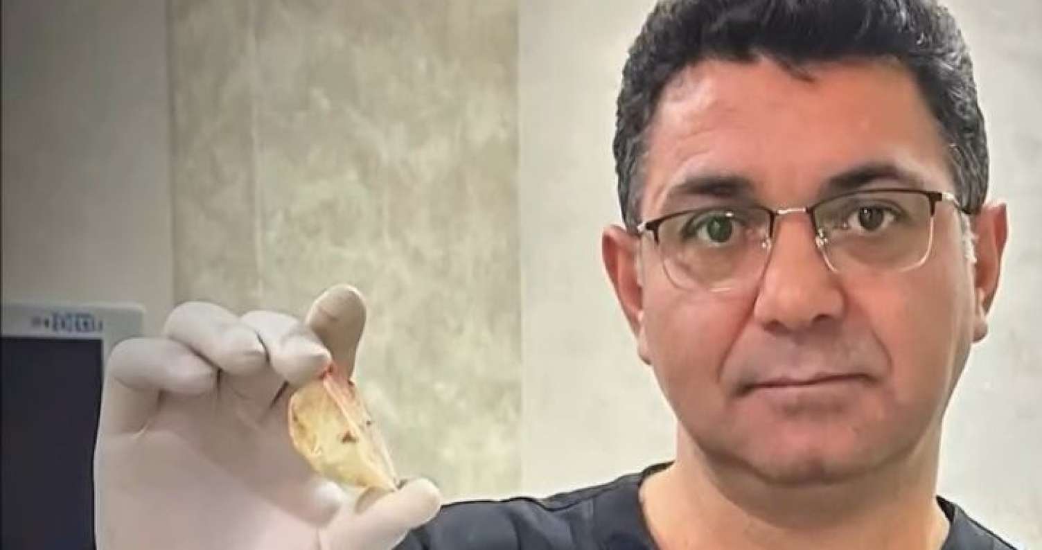 Bakıda xəstə "Rexona" qapağı uddu -  VİDEO