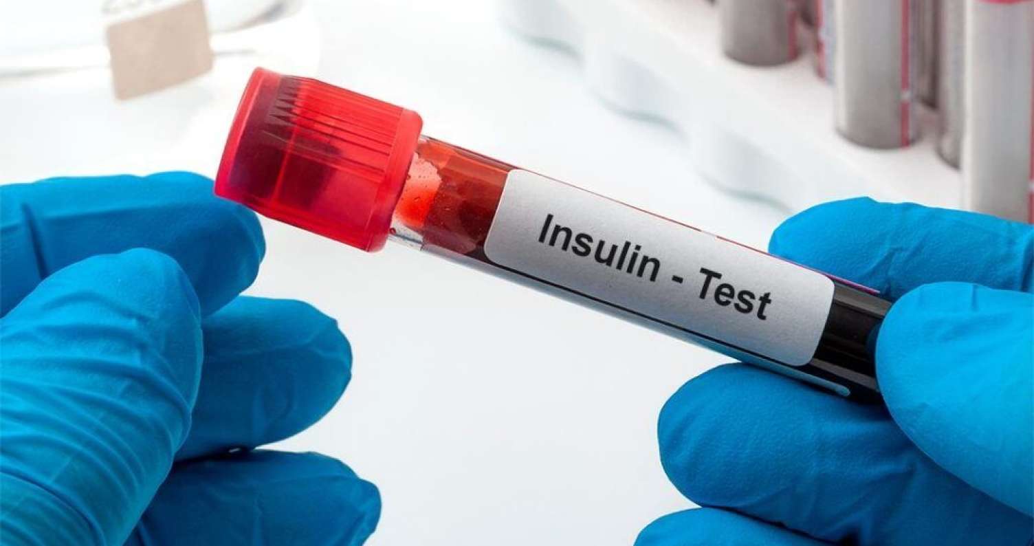 Ürək xəstəliklərinin əsas səbəbi insulin dirəncidir -  Kardioloqdan VİDEO