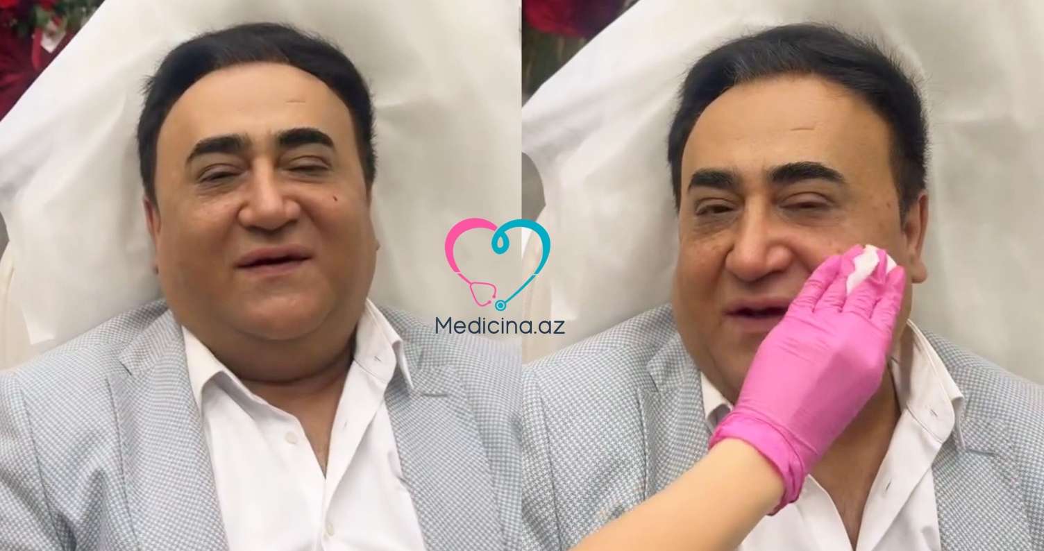 Elgiz üzünə estetik prosedurlar etdirdi -  VİDEO