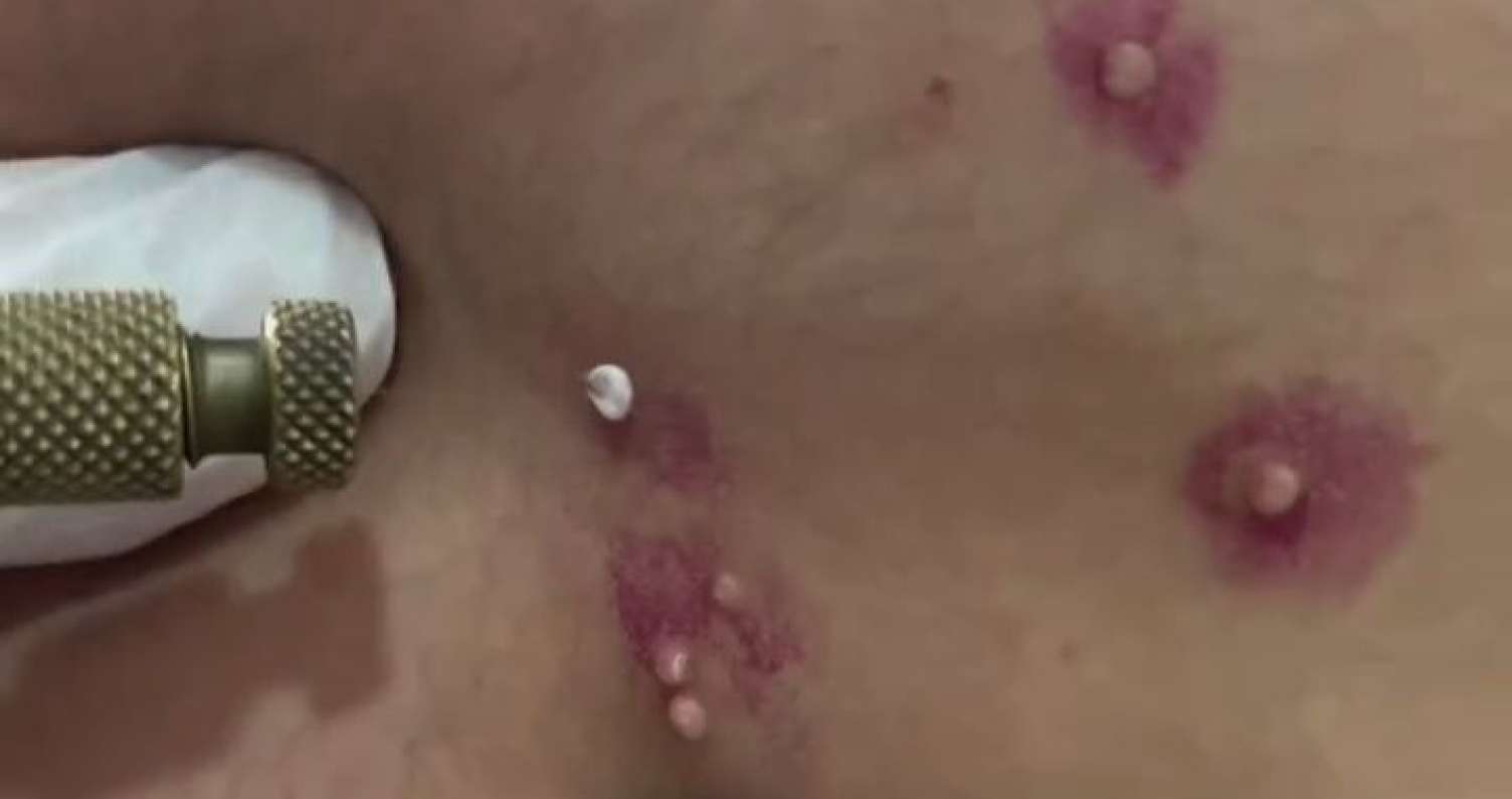 İdman zalından keçən yoluxucu virus- VİDEO