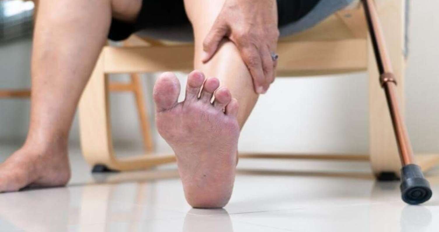 Diabetik ayaq sindromu: Amputasiyasız müalicə mümkündürmü? –  İnteqrativ tibb yanaşması-VİDEO