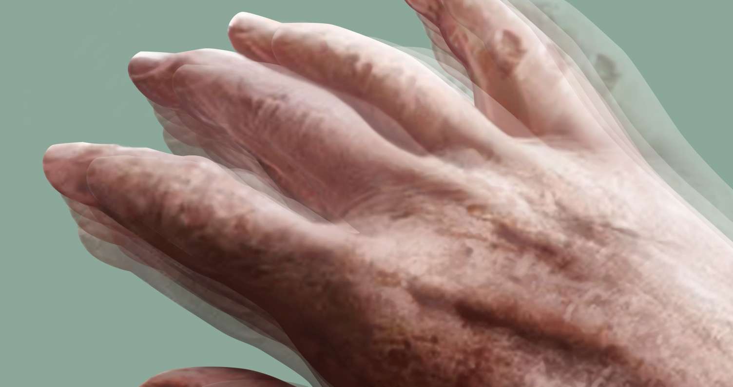 7 il Parkinson xəstəliyi ilə yaşayan pasiyentin mübarizə hekayəsi -  VİDEO