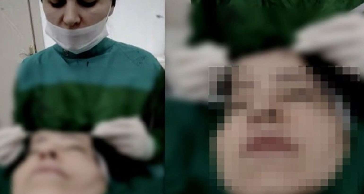 Daha bir cərrah əməliyyat zamanı canlı yayım açdı -  Araşdırma başladı