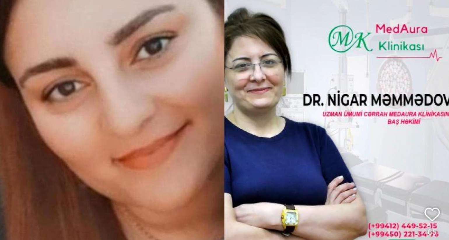 Mərcan klinikasındakı ölümlə bağlı    Nazirlikdən açıqlama