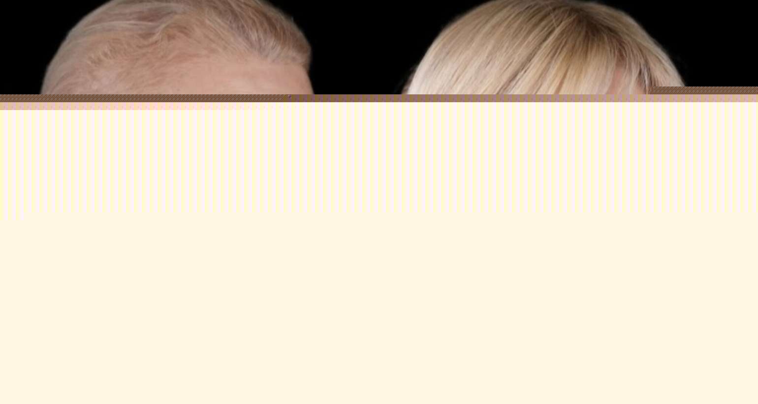 Mətanət İsgəndərlinin dəyişimi gündəm oldu -  FOTO