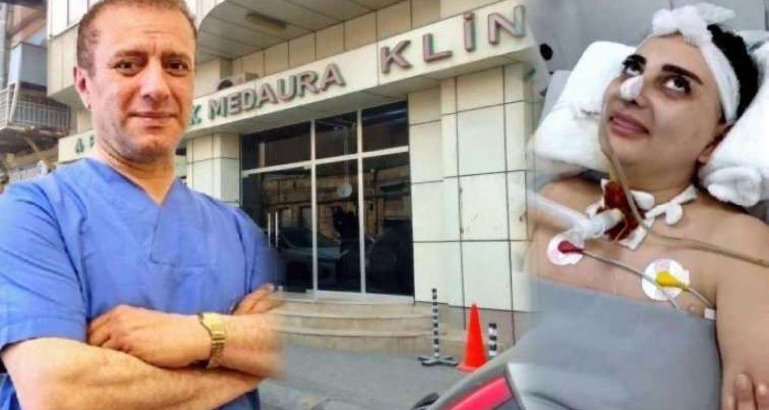 Estetik cərrah və anestezioloqla bağlı  cinayət işi açıldı