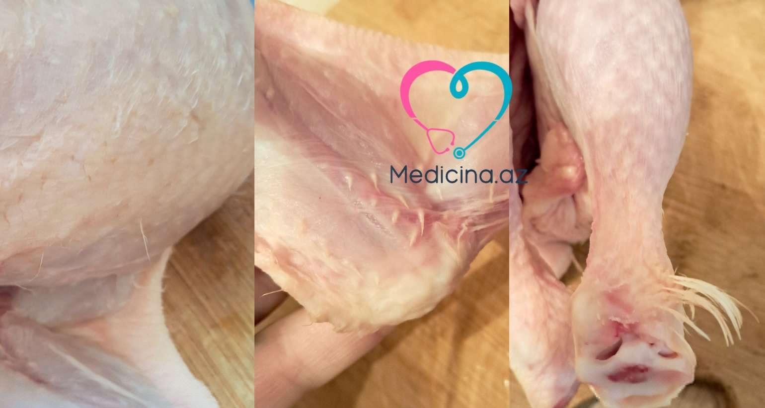 Tükü yaxşı yolunmamış broyler toyuqları təhlükəlidir? -  Açıqlama