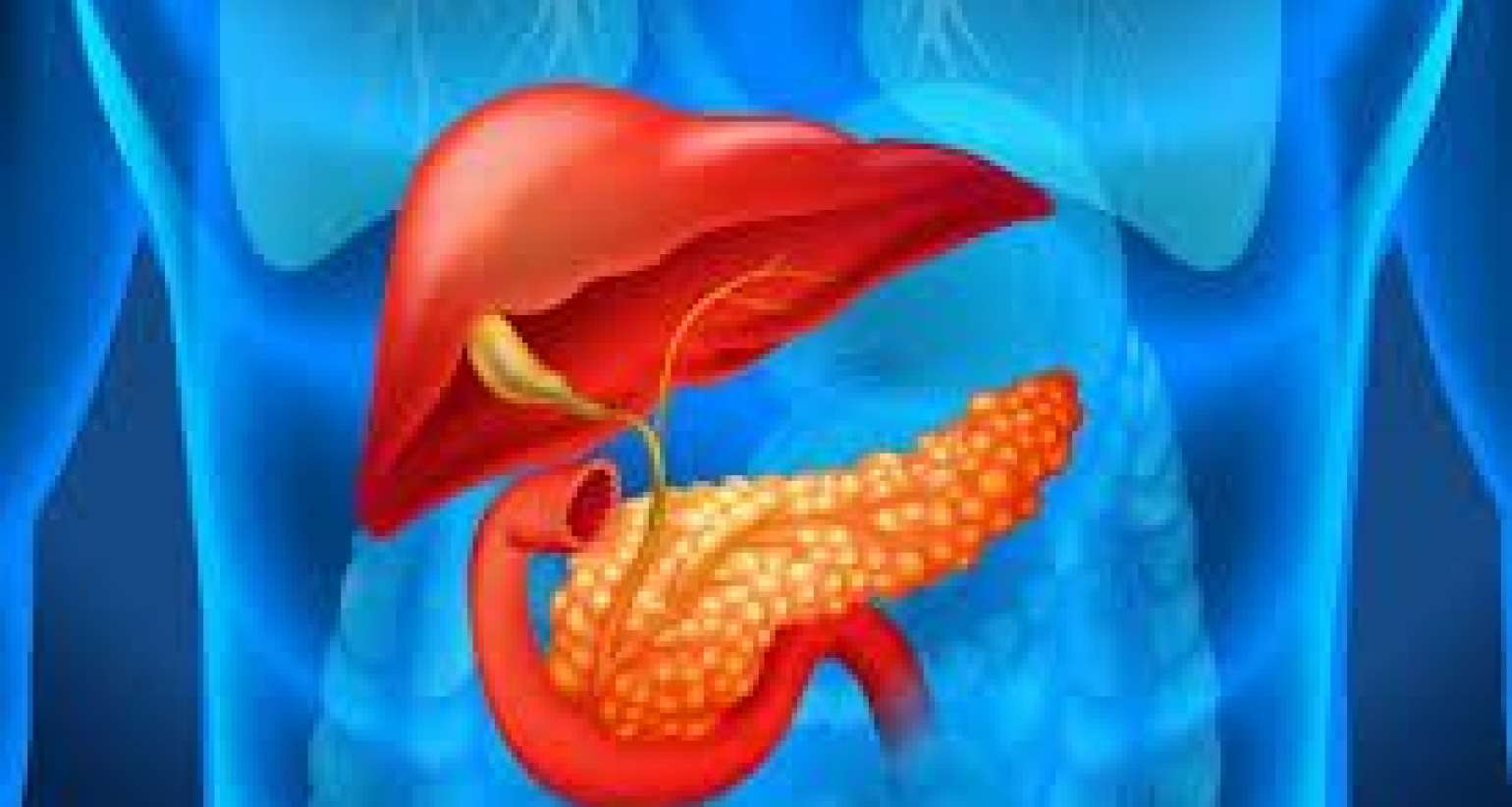 Mədəaltı vəzi xərçənginin 14 əlaməti  – Çox yeyənlərin diqqətinə!