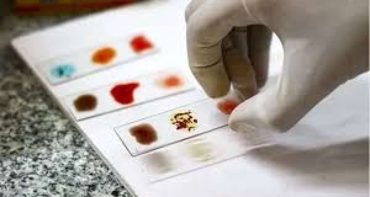 Dünyanın qızıl qan qrupu  - Azərbaycanda varmı?