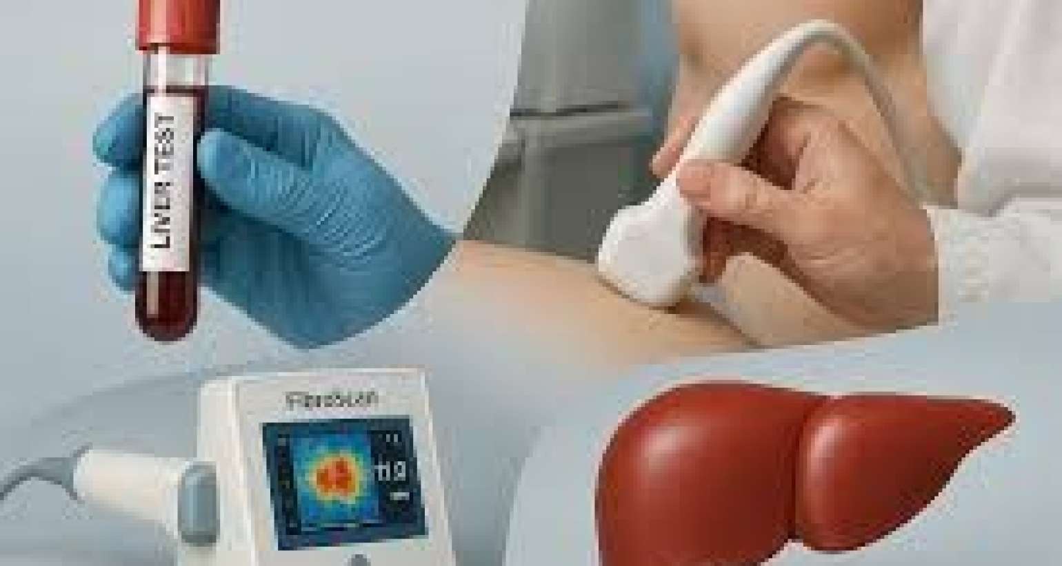 Qaraciyər sirrozu: hansı analiz və müayinələr vacibdir? 