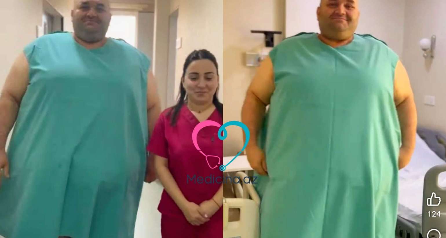 Azərbaycanda 330 kq çəkili kişi     əməliyyat olundu – Video 