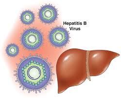  Azərbaycanda Hepatit xəstəliklərinin diaqnozu səhv aparılır –  Həkim şok faktlar açıqladı