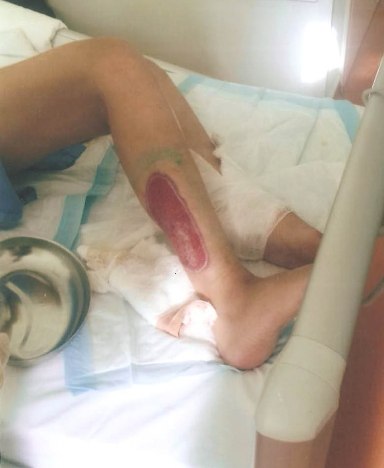 : doğmuş ananın ayaqlarını yandırdılar - FOTO “Leyla Şıxlinskaya”da dəhşət