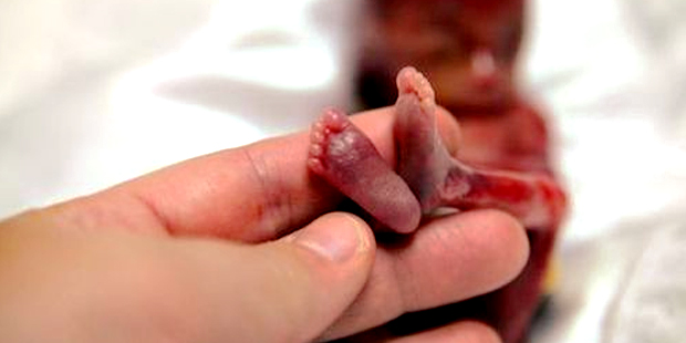  - Həkim fəsadlarını AÇIQLADI/VİDEO Abort qadının ölümü ilə nəticələnə bilər