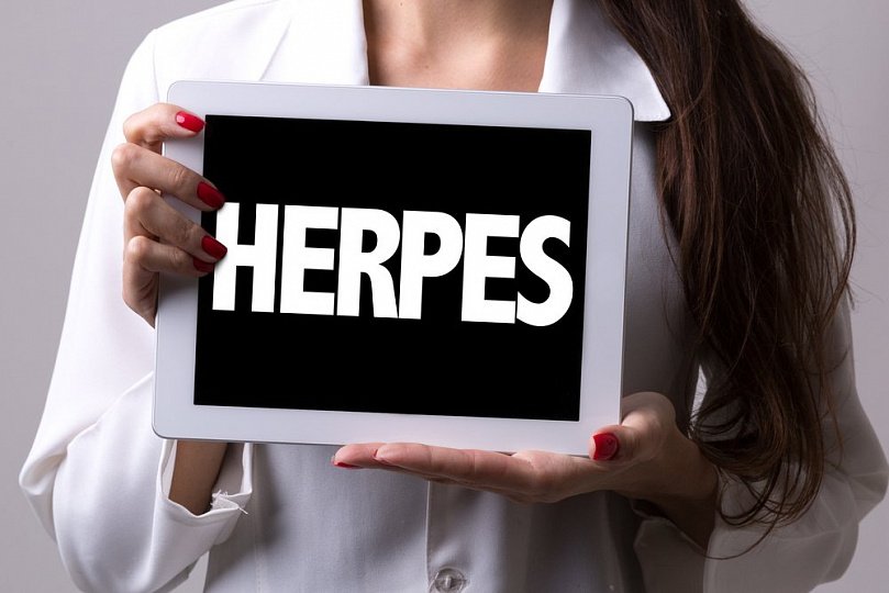 Öpüş, intim əlaqə və ağız suyu ilə yoluxan –  HERPES VİRUSU 