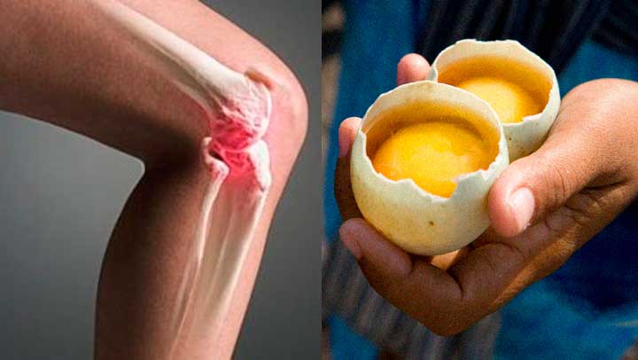 Diz ağrısına qarşı 2 yumurta –  Qədim dərman