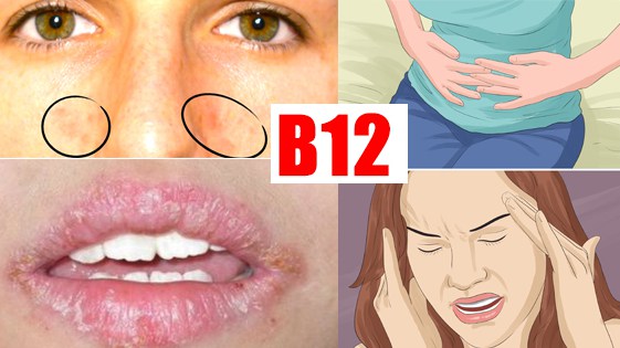 B12 vitamini çatışmadığını göstərən 5 əlamət –  yuxululuq, başgicəllənmə, ayaqlarda qıcolma