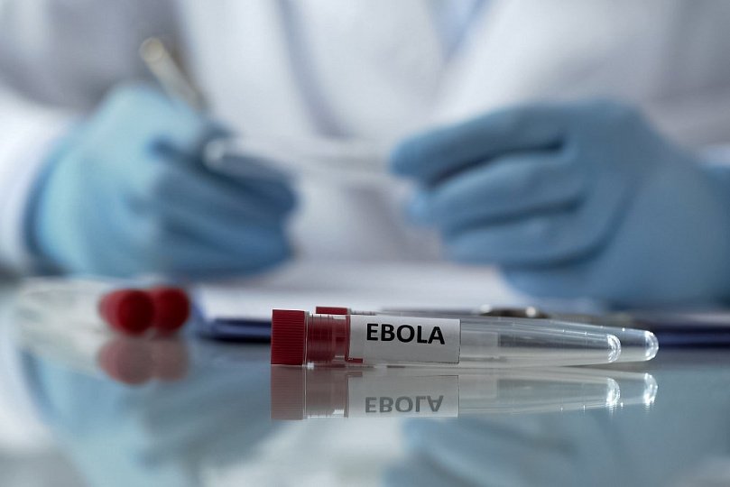 EBOLA qayıdır –  Virusun insana təsiri və qorunma yolları