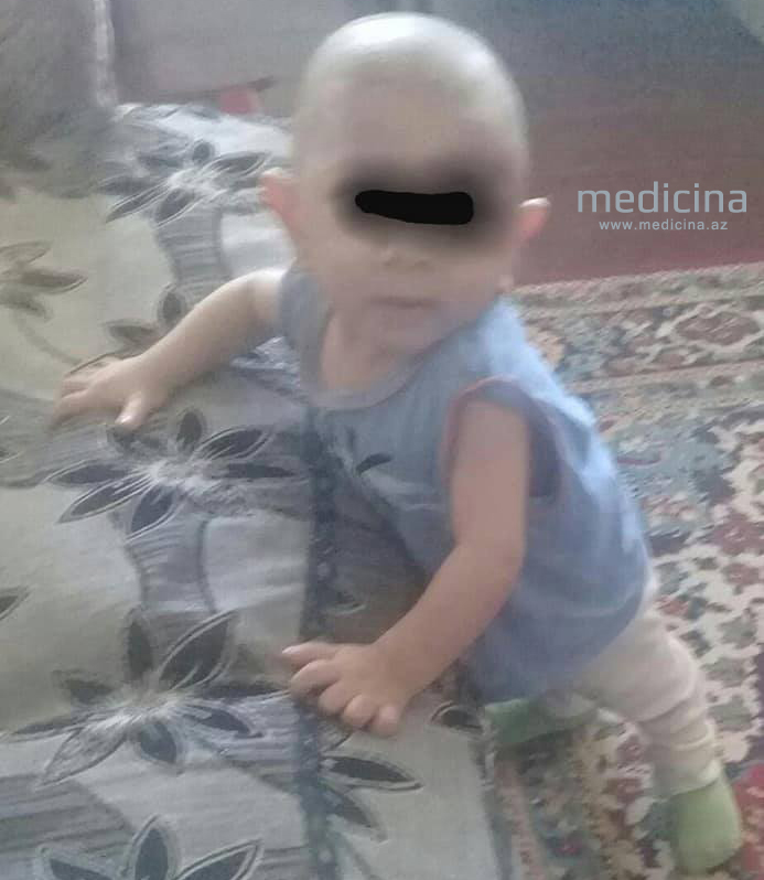 Həkimlərin “aparın, öləcək” dedikləri körpənin xilası üçün inanılmaz addım –  Azərbaycanda pediatrdan möcüzə/ FOTO