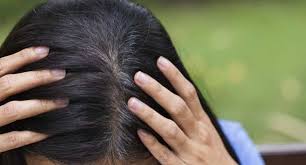 Nəyə görə stressdən saçlar ağarır –  Əsas səbəb