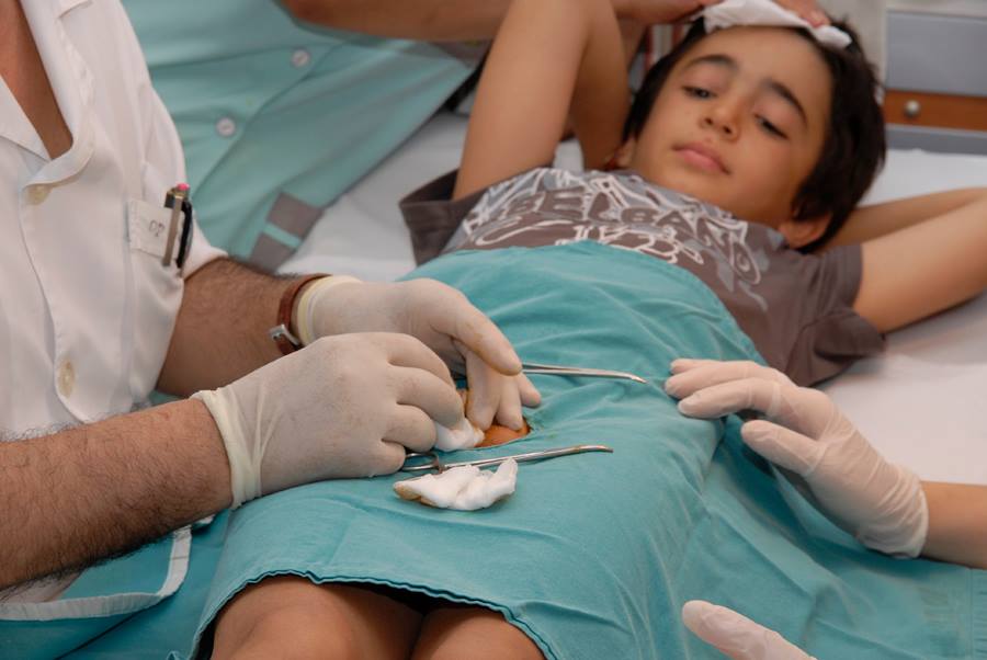 Lazerlə sünnət olunan kişilərdə xərçəng riski artır -  42 ildir, sünnət edən pediatrdan İDDİA