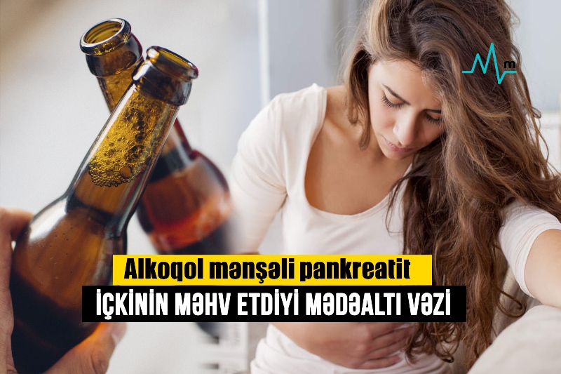 İçkinin məhv etdiyi mədəaltı vəzi -  Alkoqol mənşəli pankreatit