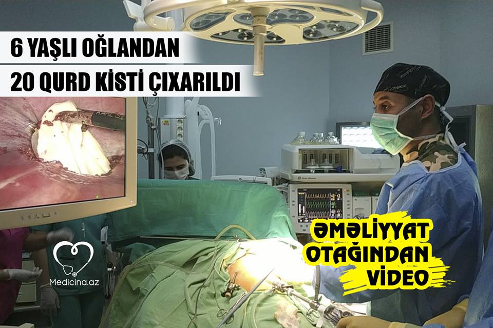 Azərbaycanda 6 yaşlı oğlandan 20 qurd kisti çıxarıldı –  Əməliyyat otağından VİDEO