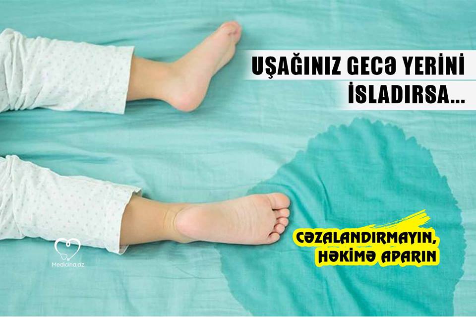 Uşağınız gecə yerini isladırsa... -  Cəzalandırmayın, həkimə aparın