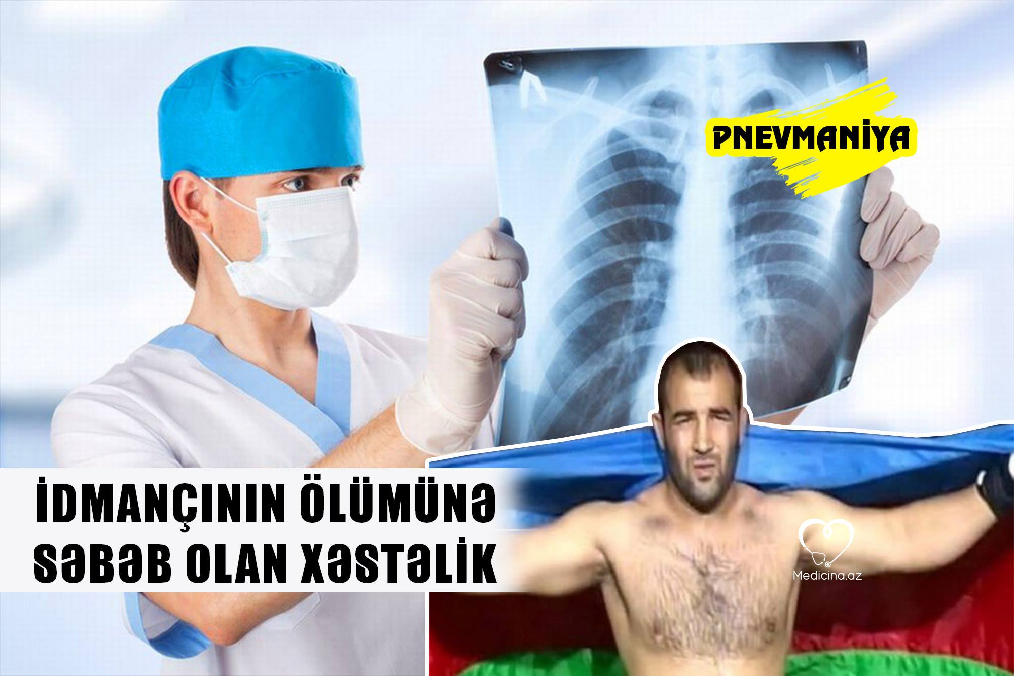 İdmançının ölümünə səbəb olan xəstəlik -  Pnevmaniya