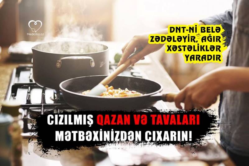 Cızılmış qazan və tavaları mətbəxinizdən çıxarın! -  DNT-ni belə zədələyir, ağır xəstəliklər yaradır