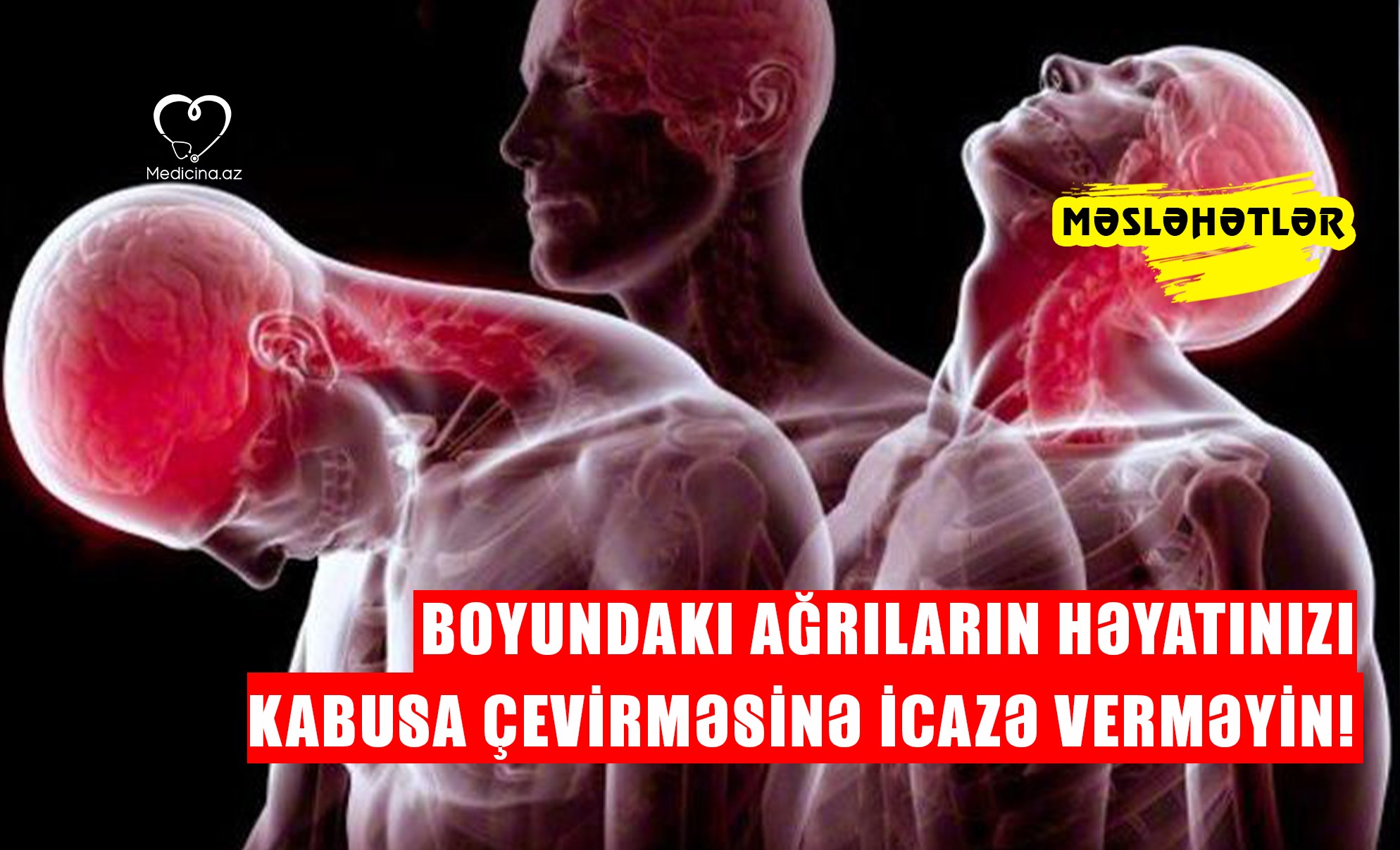 Boyundakı ağrıların həyatınızı kabusa çevirməsinə icazə verməyin! -  MƏSLƏHƏTLƏR