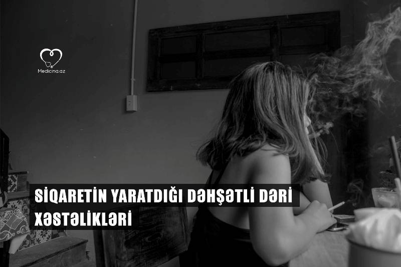 Siqaretin yaratdığı dəhşətli dəri xəstəlikləri  