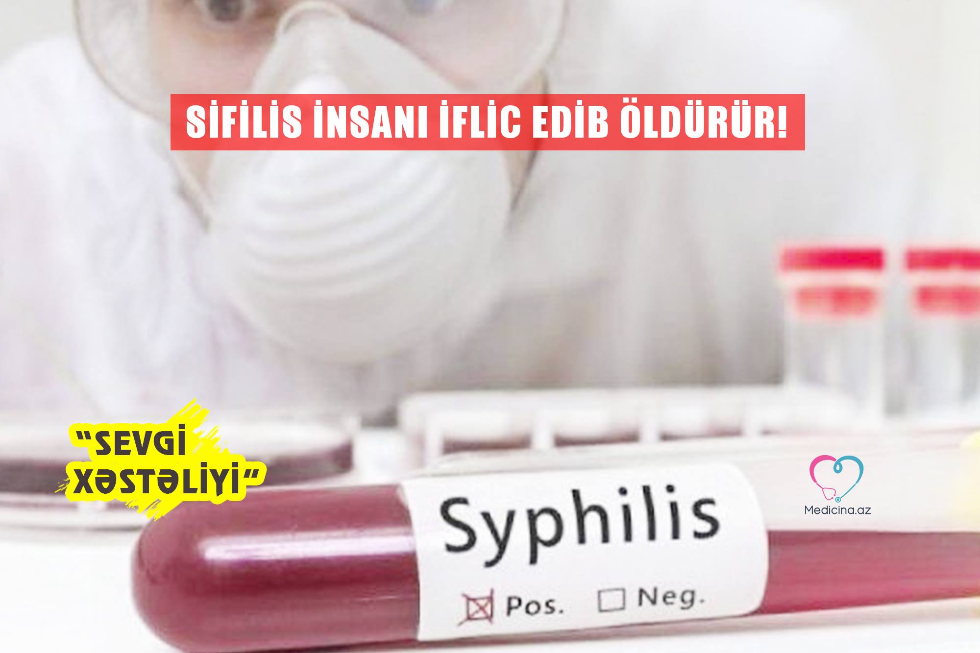 - Sifilis insanı iflic edib öldürür! “Sevgi xəstəliyi” 