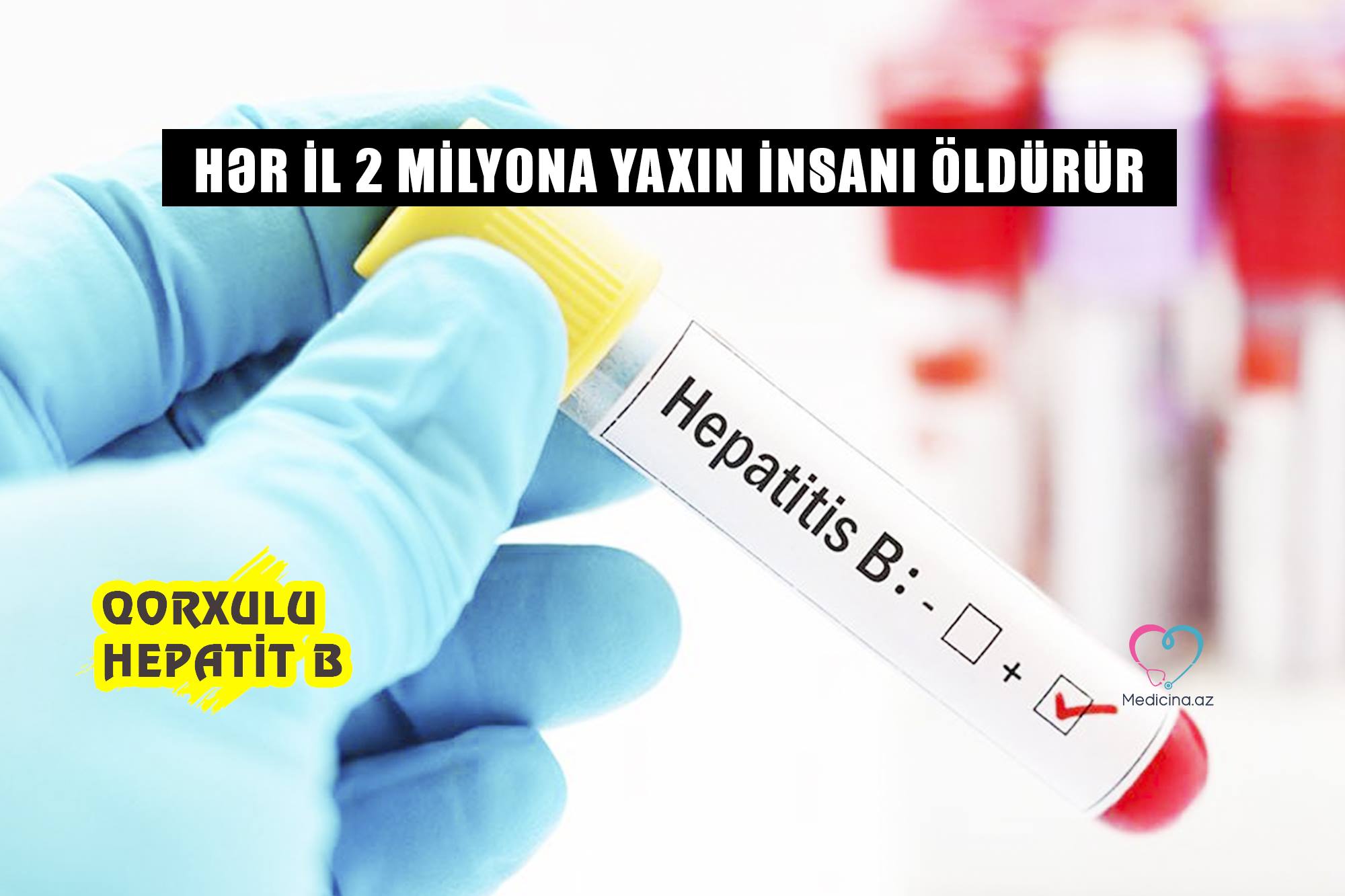 - Hər il 2 milyona yaxın insanı öldürür Qorxulu Hepatit B 