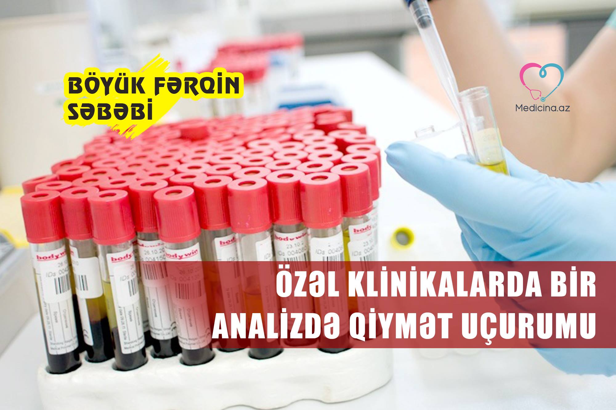 Özəl klinikalarda bir analizdə qiymət uçurumu : “Baku Clinic” 240, “Medicus” 80 manat  -  Böyük fərqin səbəbi