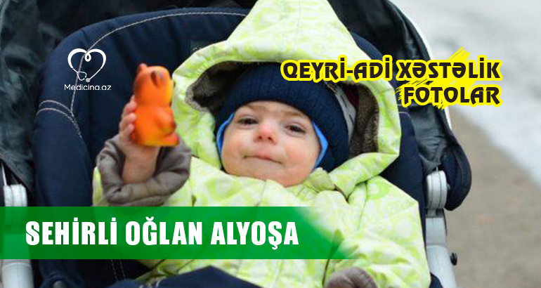  - Qeyri-adi xəstəlik - FOTOLAR Sehirli oğlan Alyoşa