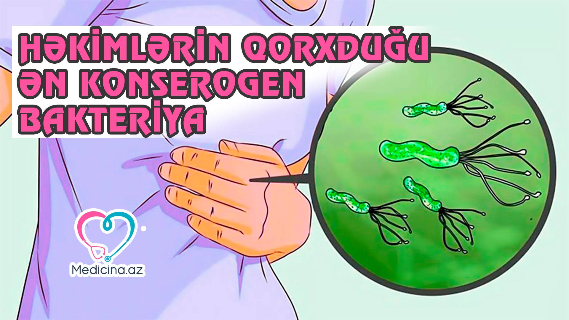 Mədə xərçənginin səbəbkarı bakteriya: Helicobacter Pylori -  VİDEO