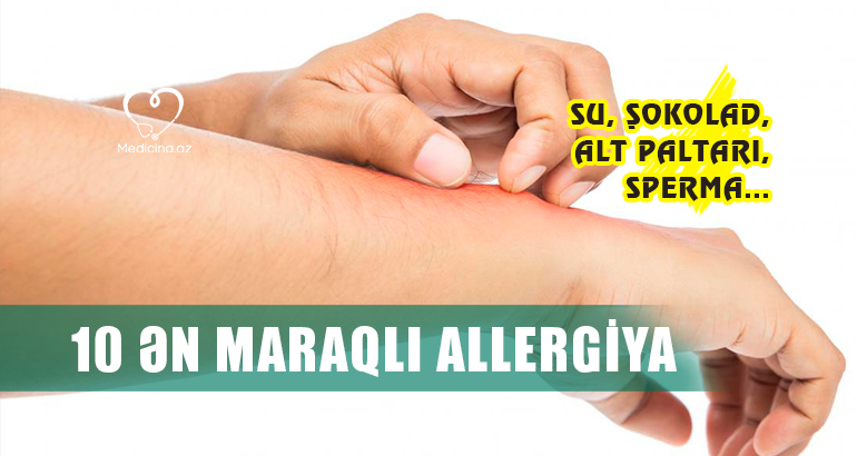 10 ən maraqlı allergiya –  Su, şokolad, alt paltarı, sperma...