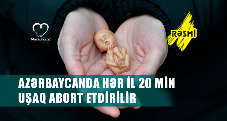 Azərbaycanda hər il 20 min uşaq abort etdirilir -  RƏSMİ