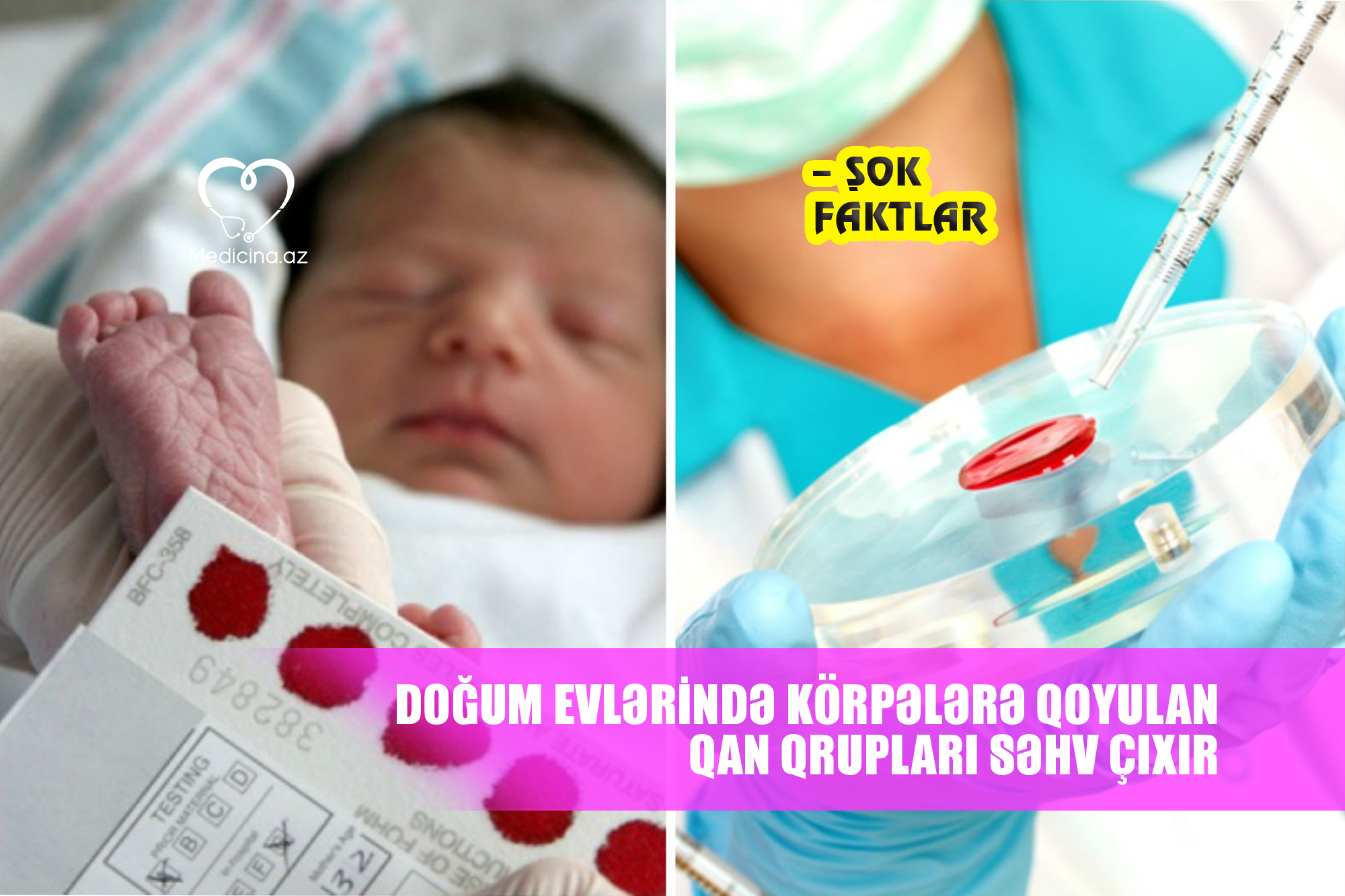 Azərbaycanın doğum evlərində körpələrə qoyulan qan qrupları səhv çıxır  –  ŞOK FAKTLAR (Araşdırma)