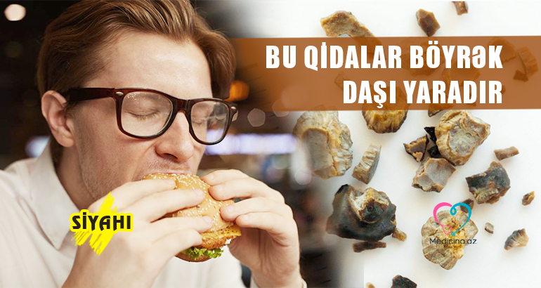 Bu qidalar böyrək daşı yaradır –  SİYAHI