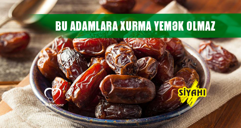 Bu adamlara xurma yemək olmaz –  SİYAHI