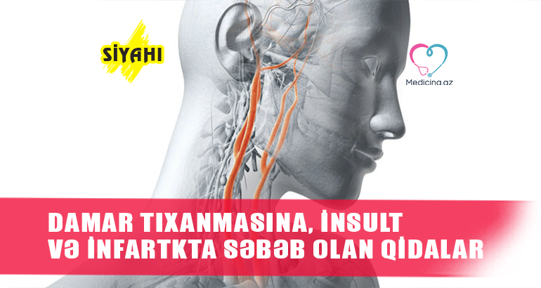 Damar tıxanmasına, insult və infartkta səbəb olan  QİDALAR - SİYAHI