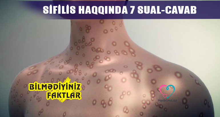 Sifilis haqqında 7 sual-cavab –  Gənclərin diqqətinə