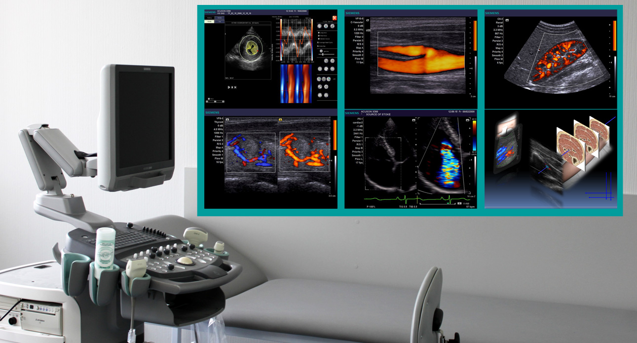  Rəngli doppler nədir və kimlərə məsləhətdir? –  Təkcə hamilələr üçün deyil