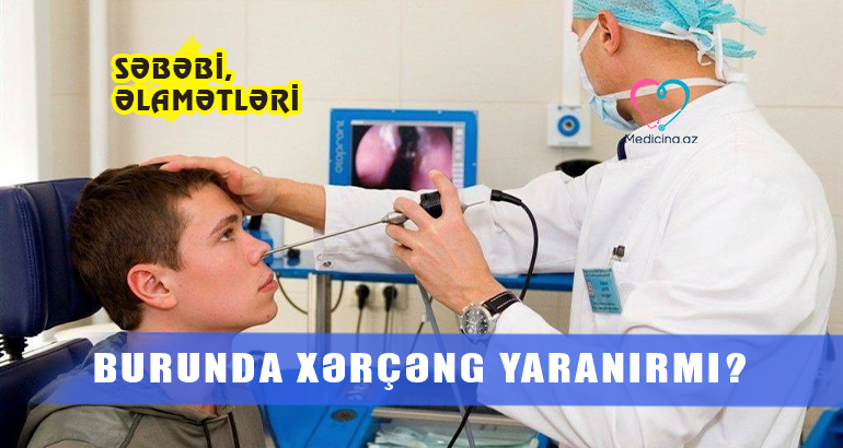 Burunda xərçəng yaranırmı? –  Səbəbi, əlamətləri